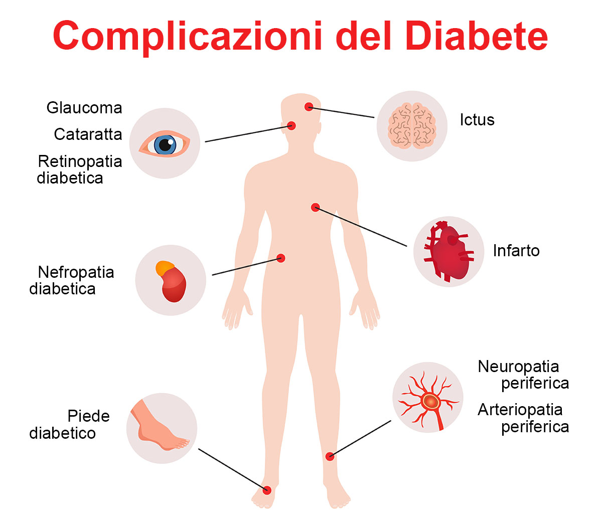 Complicazioni del diabete